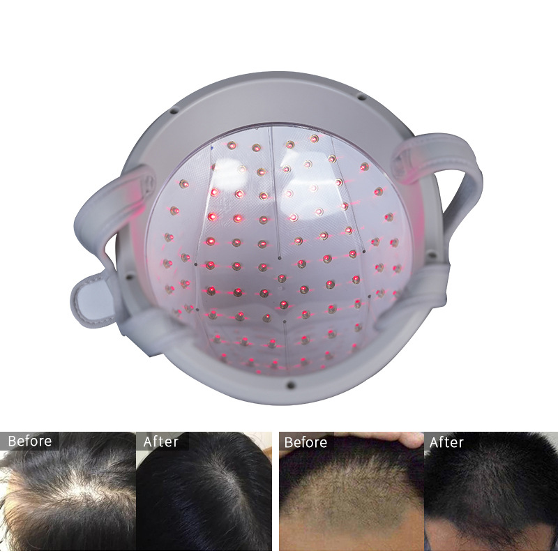 Hot Selling 82 Diode Laser Hair Growth Helmet Household Portable Laser Hair Growth Instrument Anti-Hair Loss Hair Growth Red Light Physiotherapy Cap