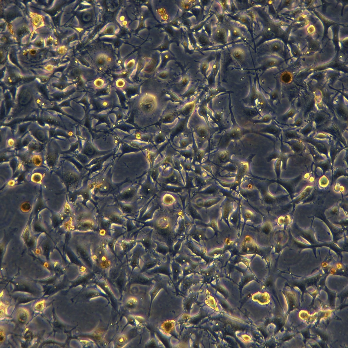 Meisenctcc Mouse Melanoma Cells B16F10-Ova