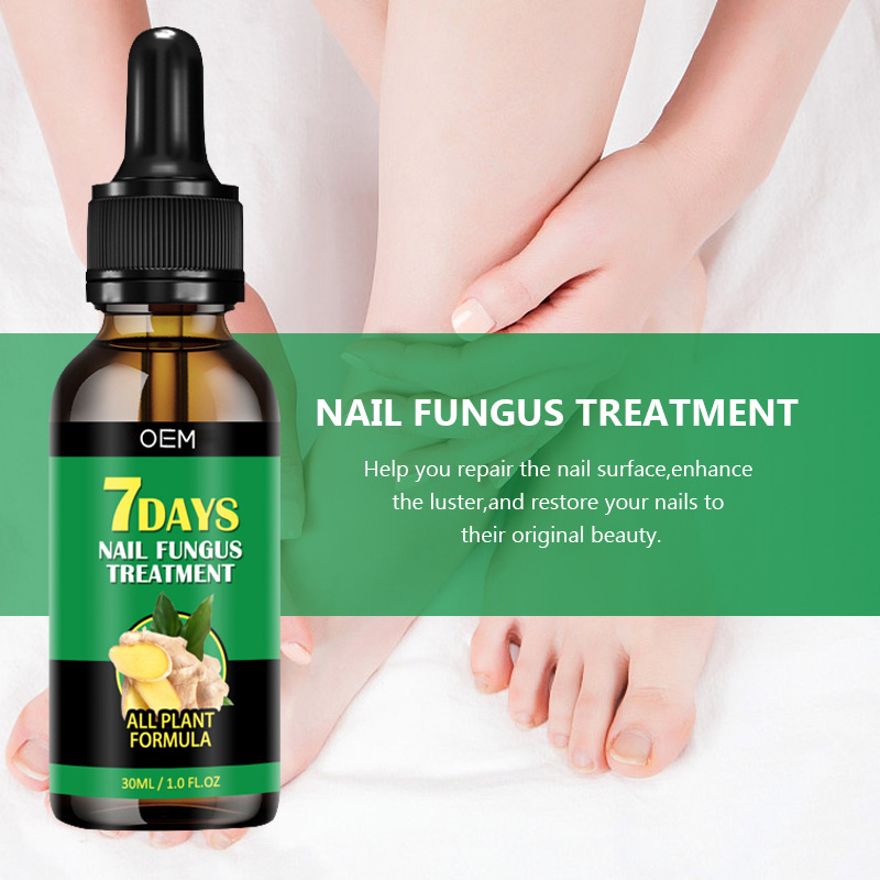 Cross-Border Same Style Ginger Nail Care Solution Oem Processing Nail and Foot Nail Repair Nourishing Bright Nail Care Solution Customization