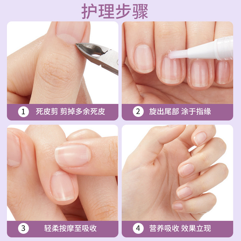 Nail Cream Source Manufacturer, Manicure Care Cream, Nutritional Oil, Nail Care, Brightening Nail Surface, Manicure Finger Edge Oil Factory