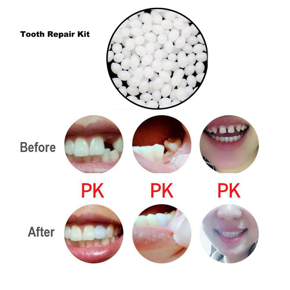 DIY repair gutta percha temporary tooth filling false shapeable tooth glue instant smile
