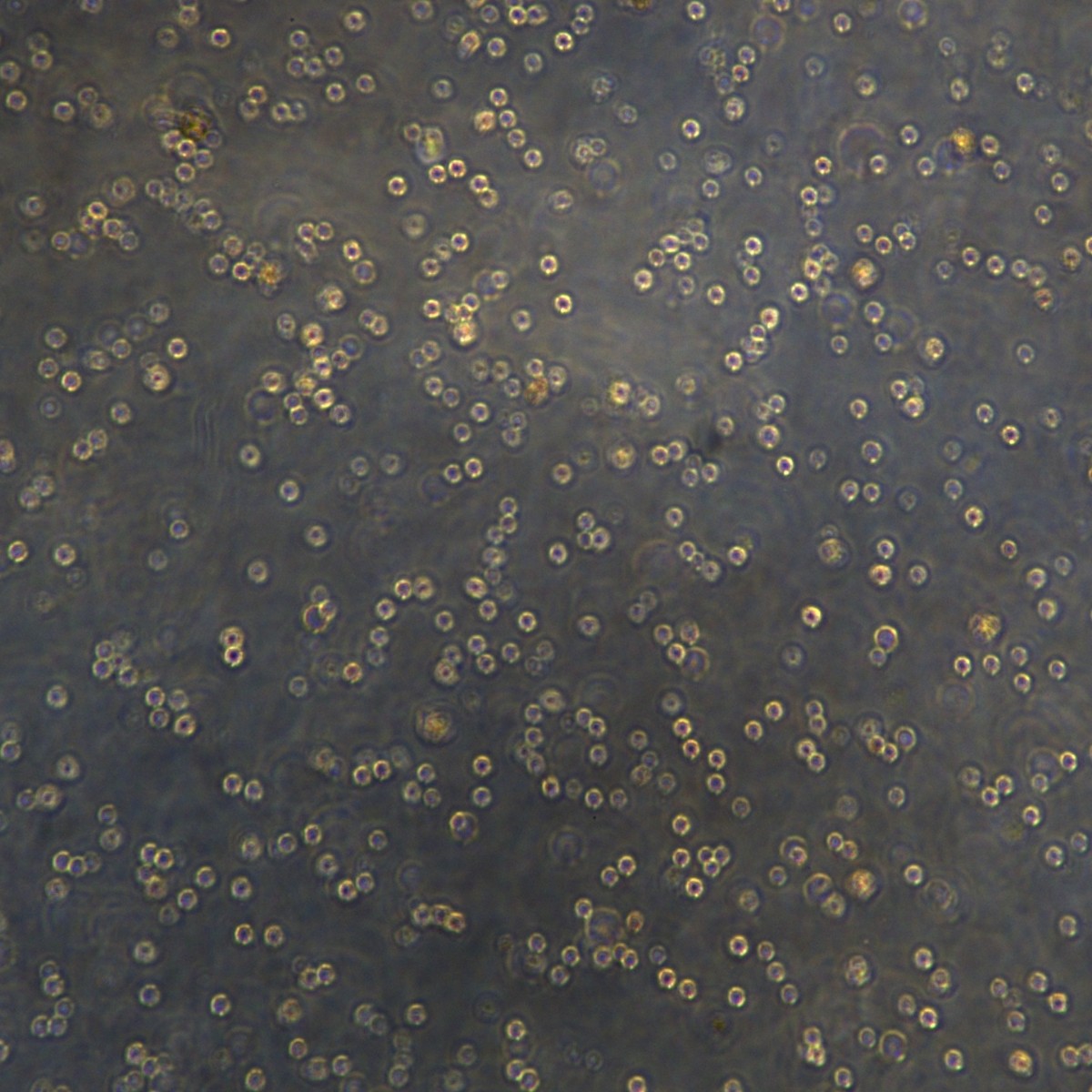 Meisen Ctcc Chronic Myeloid Leukemia/Illness Imatinib Resistant Strain K562/Imatinib