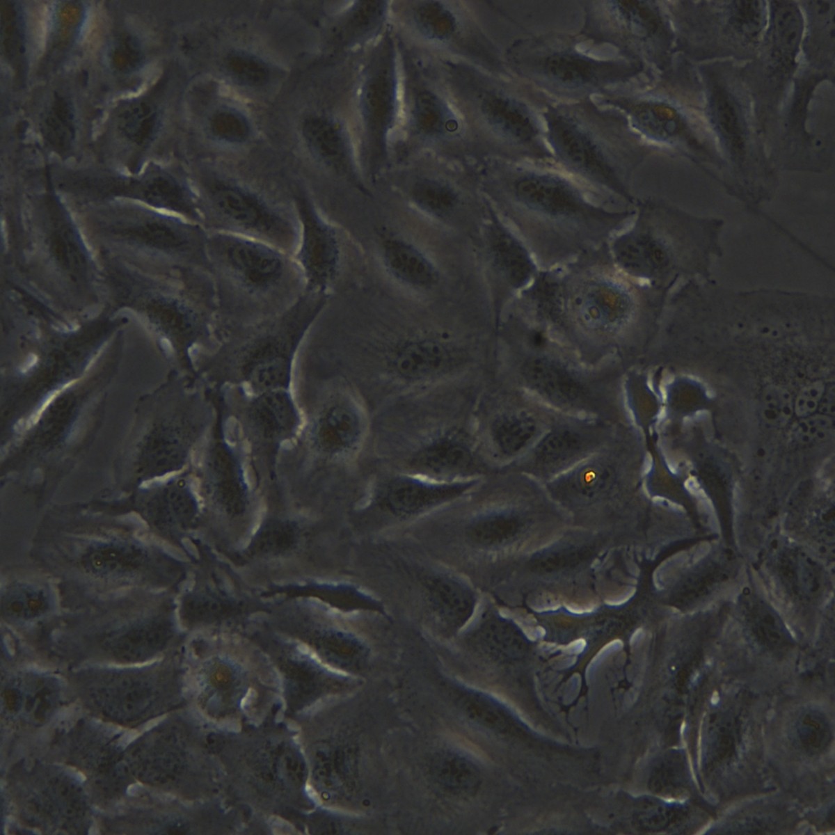 Meisenctcc Human Bile Duct/Cancer Fluorouracil Resistant Strain Rbe/5-Fu