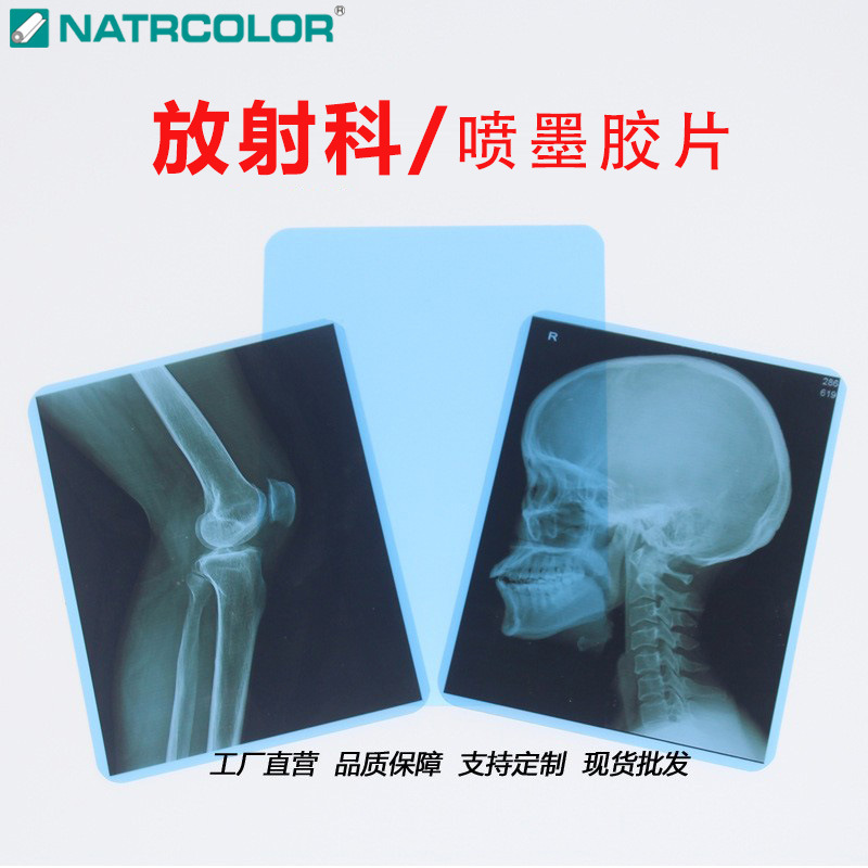 Рентгеновская пленка синего цвета, пленка для струйной печати 8*10, пленка для сухой визуализации, производитель медицинской сухой пленки