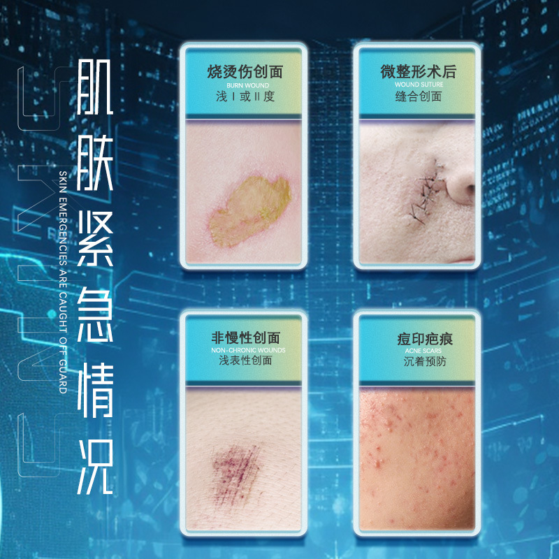 Yinhua Tang Medical Recombinant Type Iii Humanized Collagen Repair Gel Expires in December 2026 Excellent