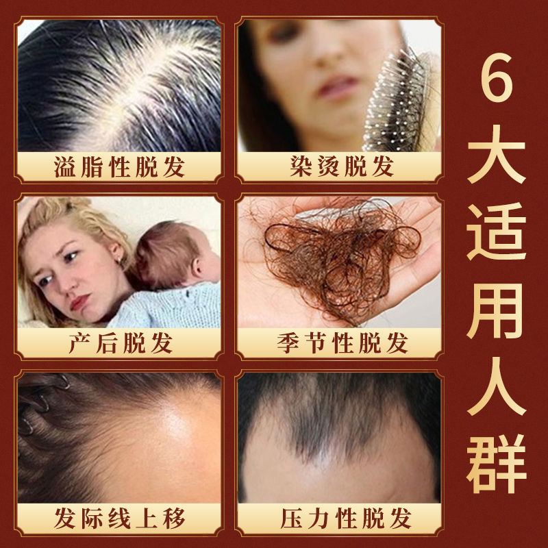 Herbal anti-hair loss hair growth liquid hair growth dense hair tough hair root hairline growth liquid hair growth liquid hair growth liquid