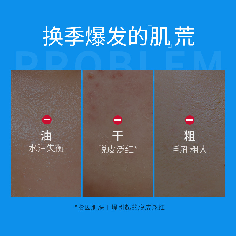 Jewell Refreshing Moisturizing Gel 100ml Men's Hydrating Face Oil Moisturizing and Refreshing Autumn and Winter Skin Care