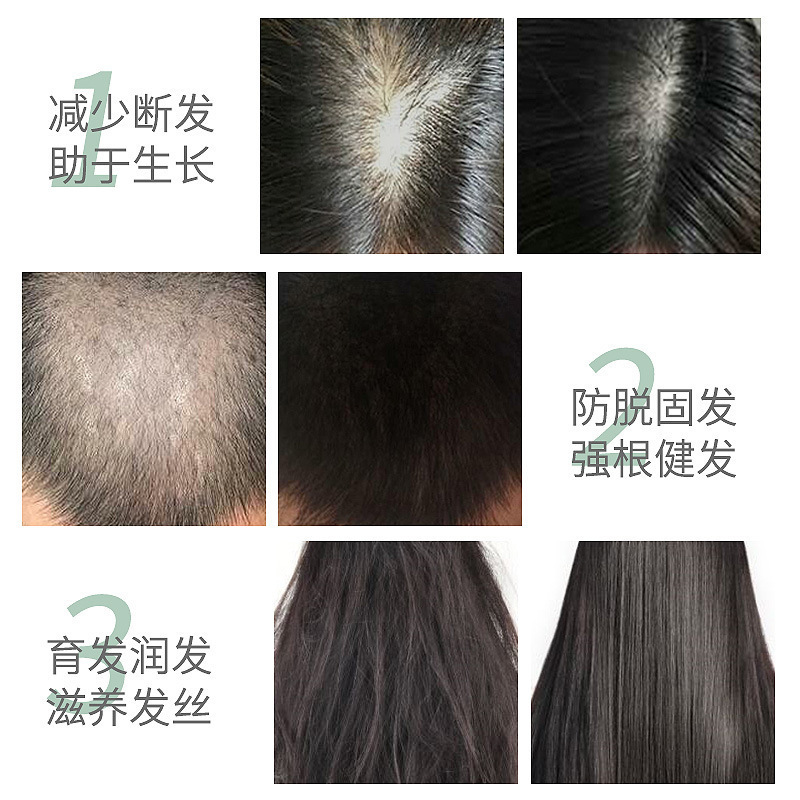 Herbal anti-hair loss hair growth liquid hair growth dense hair tough hair root hairline growth liquid hair growth liquid hair growth liquid