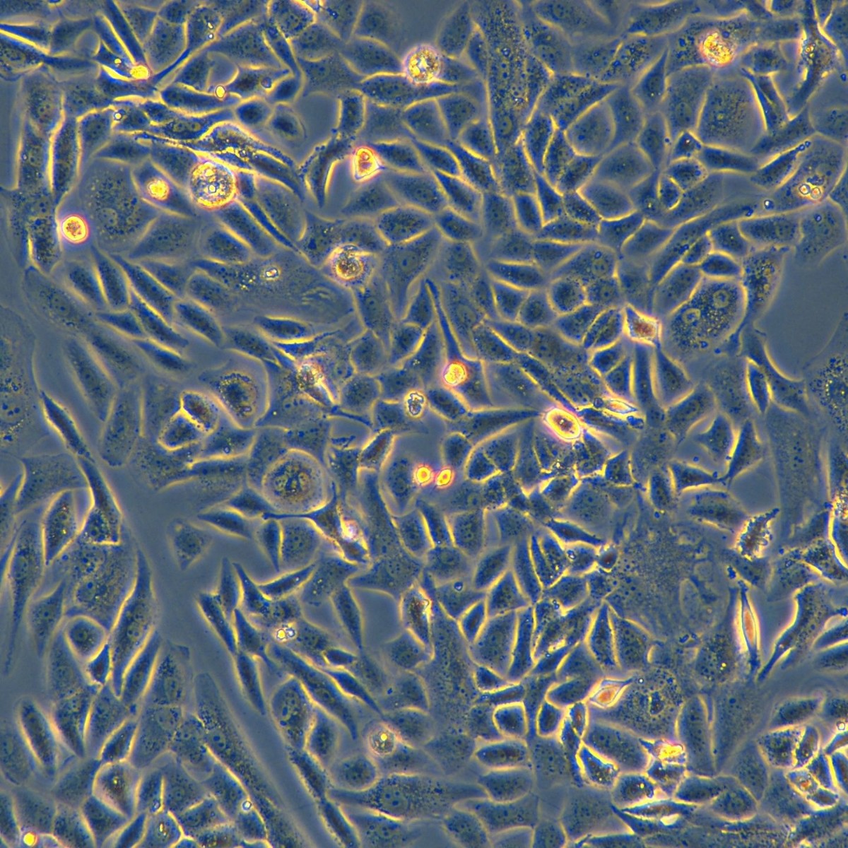 Meisen Ctcc Meisen Human Low-Differentiated Lung Adenocarcinoma Cells Sk-Lu-1