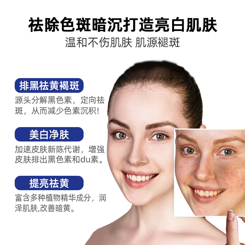 Non-Invasive Spot-Removing Liquid for Chloasma, Sun Spots, Dermal Spots, Freckles, Whitening Essence, Spot-Removing Water, Cosmetics