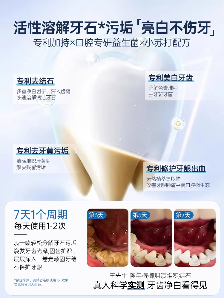 Dental Calculus Remover, Medical Dissolving, Quick-Acting Mouthwash for Cleaning Teeth, Yellow Stains and Stains, Cleaning Artifact