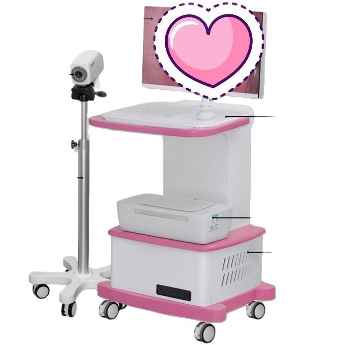 Xuzhou Xinma Electronic Colposcope Price Digital Colposcope Electronic Colposcope Digital System Mirror Manufacturer