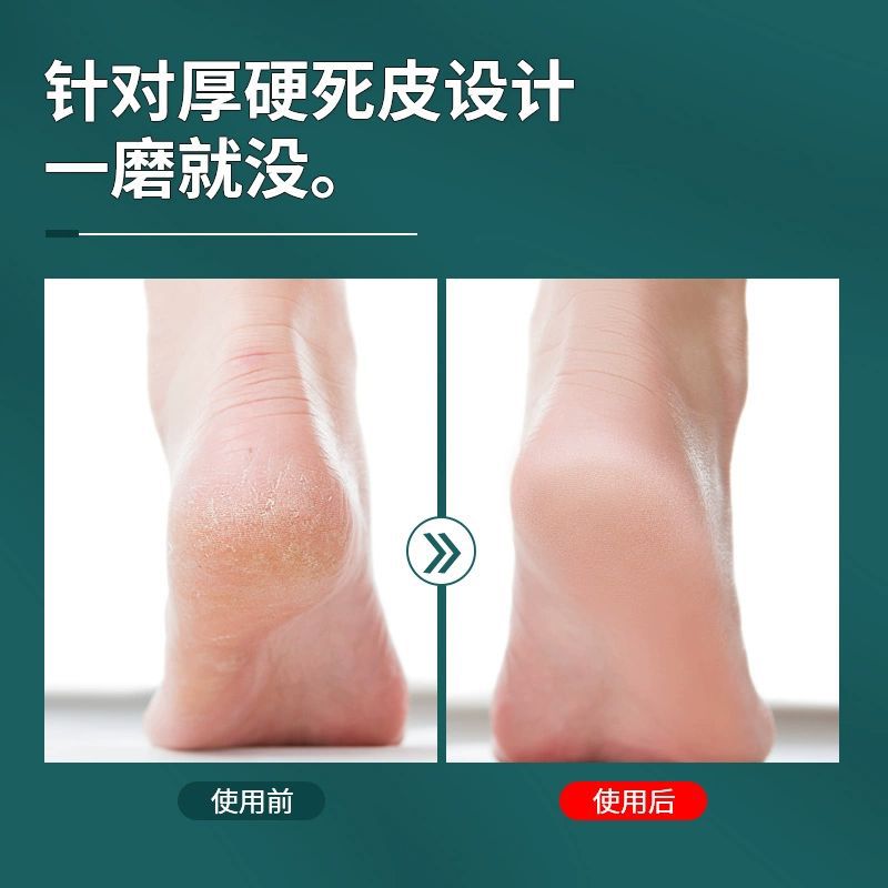 Double-Sided Foot Scrubber, Foot Grinder, Dead Skin Remover, Heel Callus Remover, Foot Scrubber, Universal Pedicure Tool