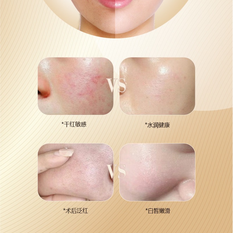 Spot Wholesale Youth Polypeptide Mask Repairs Cold Compresses, Reduces Redness, Removes Sensitivity, Shrinks Pores, Hydrates, Moisturizes and Brightens the Mask