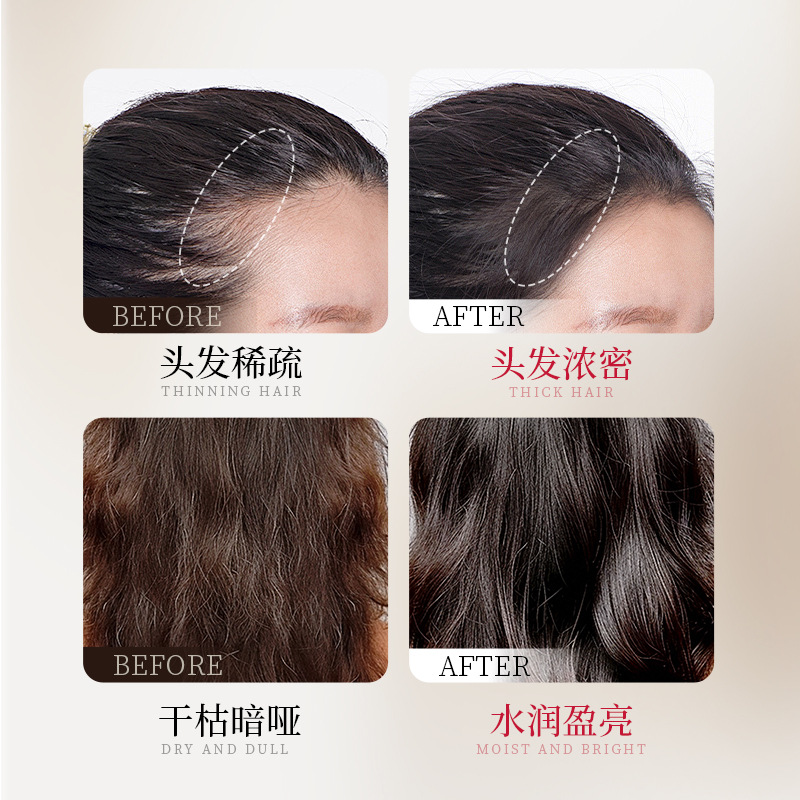 Mori's Declaration Anti-hair Anti-hair Anti-hair Anti-hair Anti-hair Anti-hair Anti-hair Anti-hair Anti-hair Anti-hair Anti-hair-fixing Essence