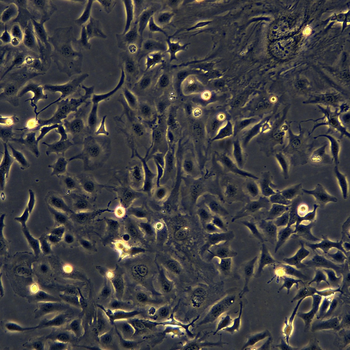Meisen Ctcc человеческая аденокарцинома яичников, штам, устойчивый к цисплатину Sk-Ov-3/Ddp