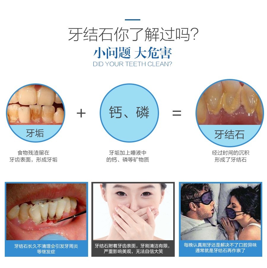 First-Generation Dental Cleaner, Teeth Whitening Device, Tartar Remover, Electric Dental Cleaner, Ultrasonic Teeth Whitening and Cleaning