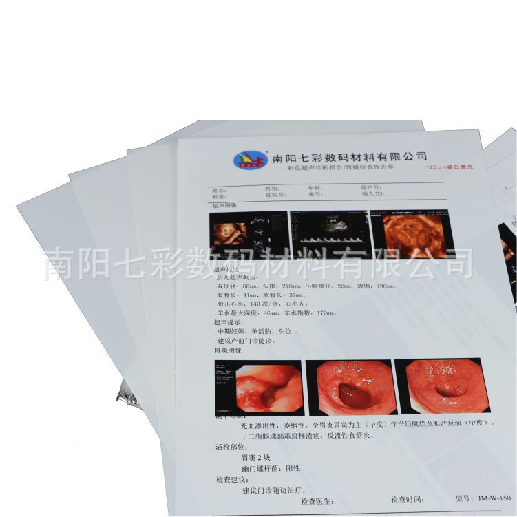 125Miu Porcelain White Laser Medical Film A4 White B-Ultrasound Color Four-Dimensional Ultrasound Film