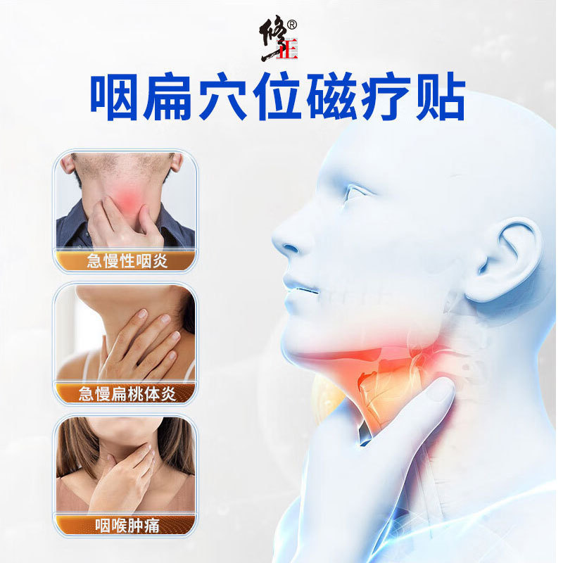 Correction of Pharyngeal Flatness Acupuncture Magnetic Therapy Patch Device, Pharyngitis Patch Specifically for Acute and Chronic Pharyngitis and Tonsillitis, External Use Wholesale
