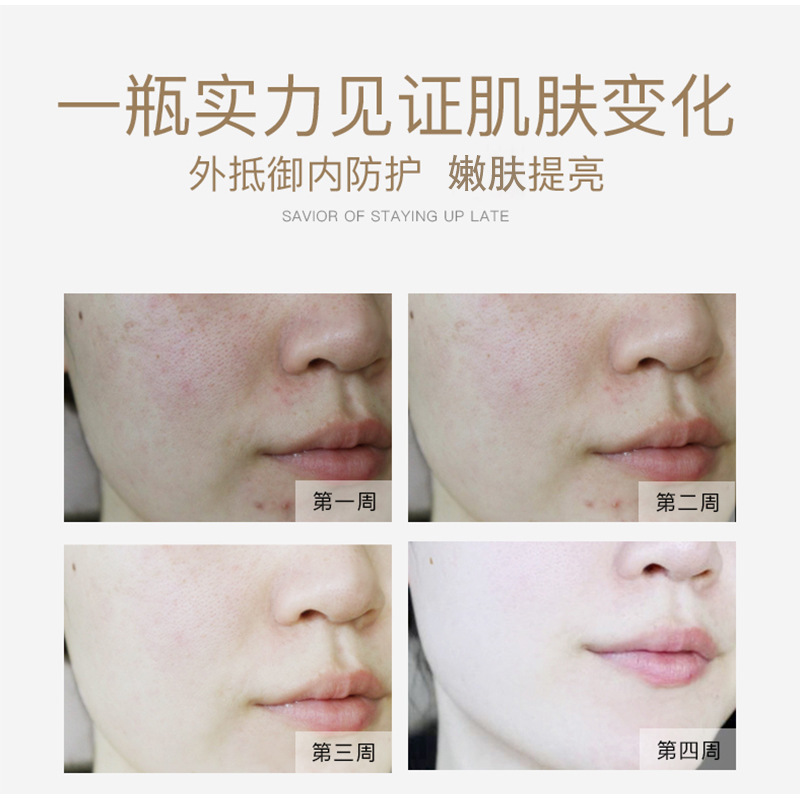 Niacinamide Original Solution %10 High Concentration Large Bottle Improves Dark Yellow Skin Tone, Brightens Skin Tone, Controls Oil and Moisturizes Niacinamide Essence