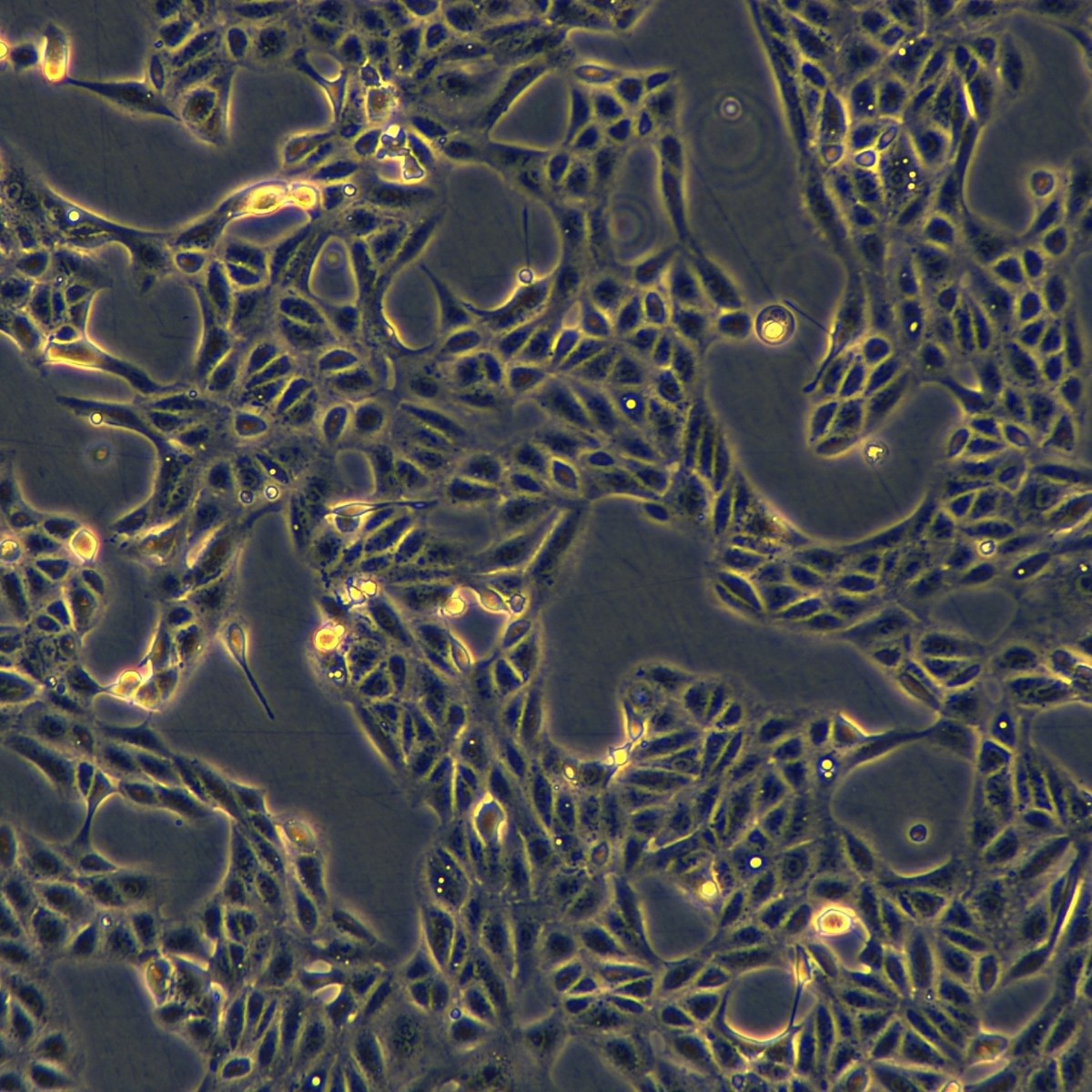 Meisen Ctcc Meisen аденокарцинома почки человека, штам, устойчивый к сорафенибу Achn/Sorafenib