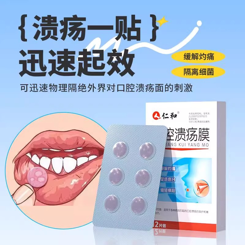 Renhe Oral Ulcer Film, Oral Ulcer Heat Clearing and Shortness of Breath, Suitable for Painful Mouth and Tongue Pain, Wholesale Delivery 1 2 Tablets Per Box