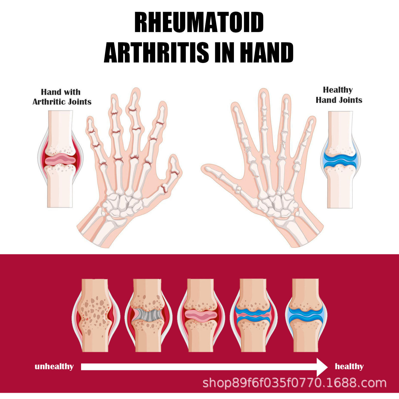 Joint Bone Collagen Cream Soothes Joint Bone Pain, Deformation Correction and Repair 30g Box