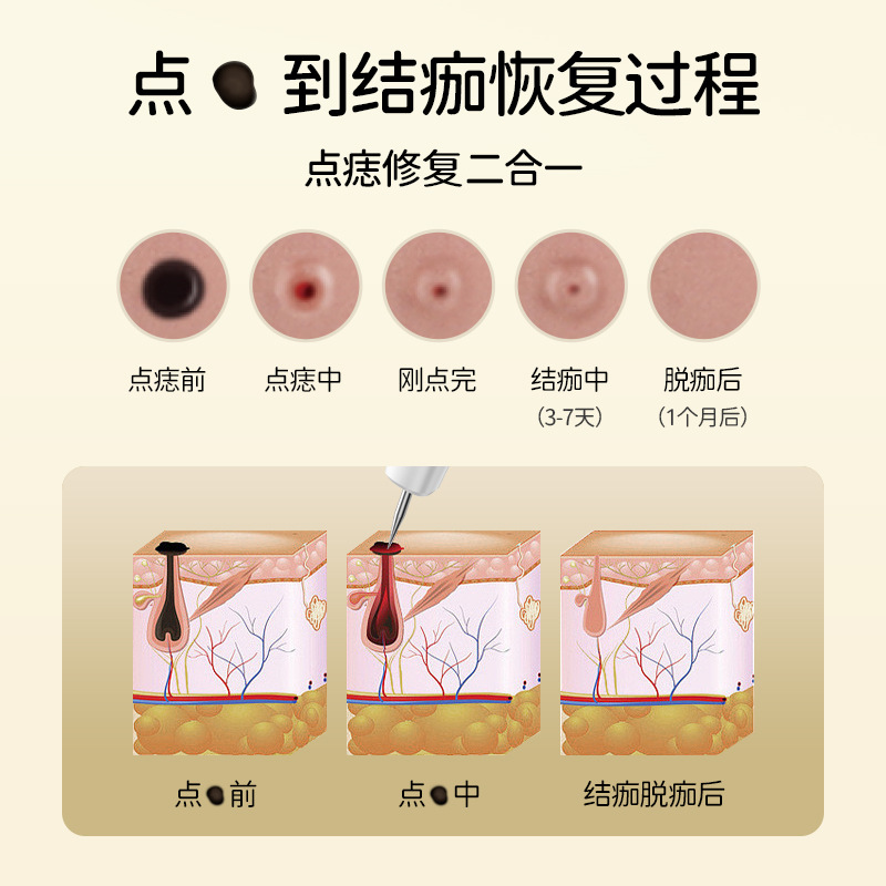 Cross-border Hot Sale Portable Painless Laser Dot Moles Instrument Handheld Electric Small White Dot Moles Pen Beauty Salon Instrument