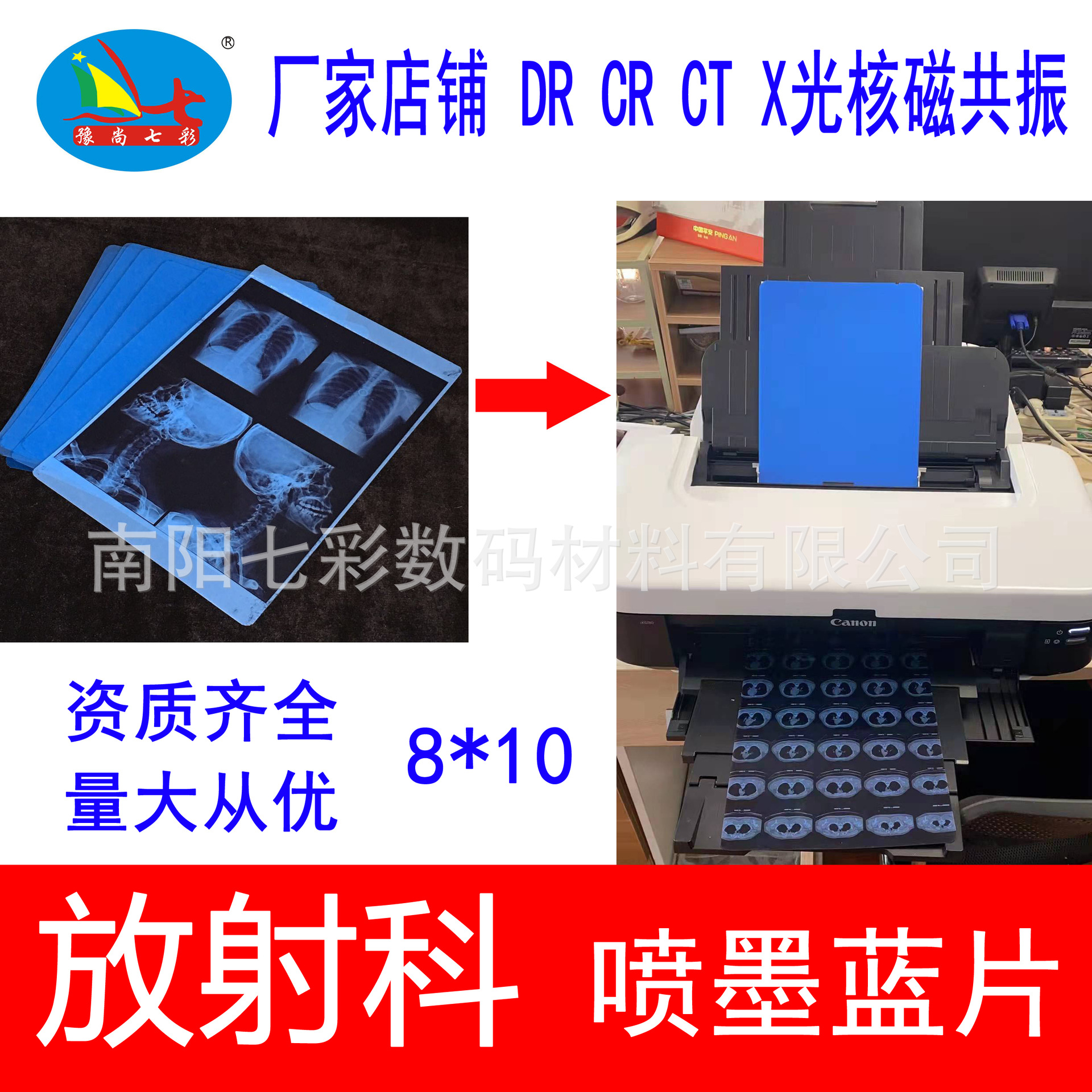 8*10 "Рентгенологическое отделение ортопедическая стоматологическая медицинская синяя струйная пленка для КТ КР ДР рентгеновская ядерная магнитно-резонансная печать