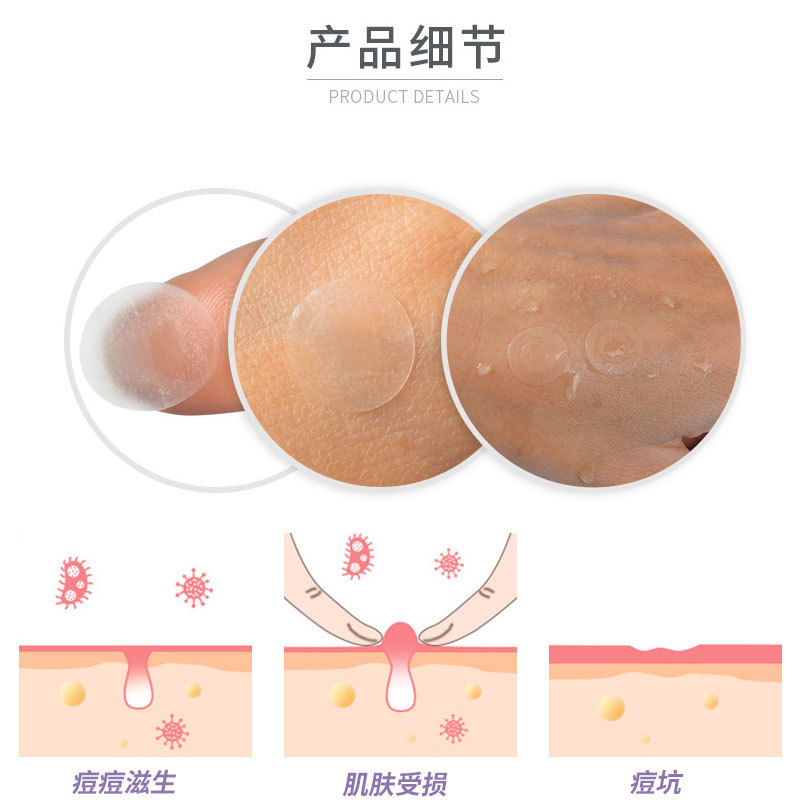 24 Capsules of Edge-Pressed Hydrocolloid Acne Patches, Round Moisturizing and Pus-Absorbing Acne Patches, 12 Capsules of Transparent Essential Oil Acne Patches, Invisible