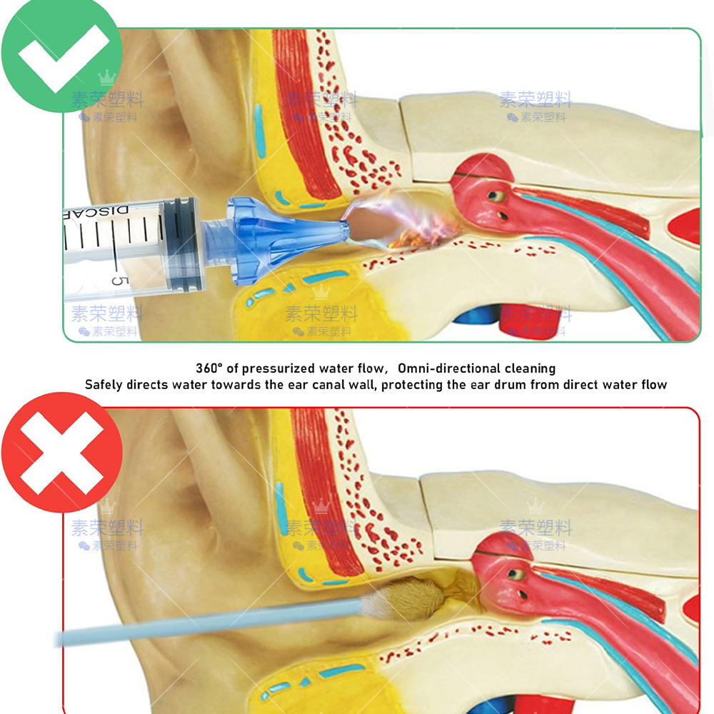 Cross-Border Syringe Ear Cleaner Household Convenient Ear Cleaner Earwax Cleaning Tool Syringe Ear Rinser Ear Cleaning Head