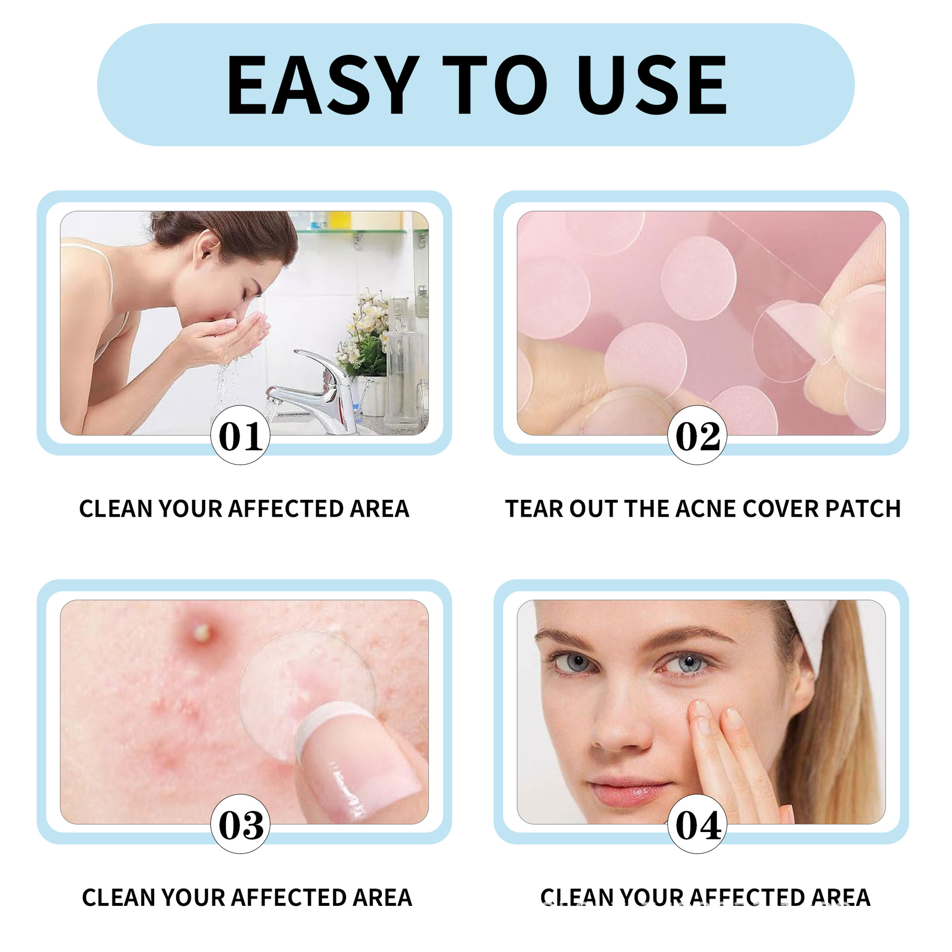 Cross-border in stock acne stickers 36 acne stickers foreign trade workers waterproof Amazon foreign trade acne concealer stickers