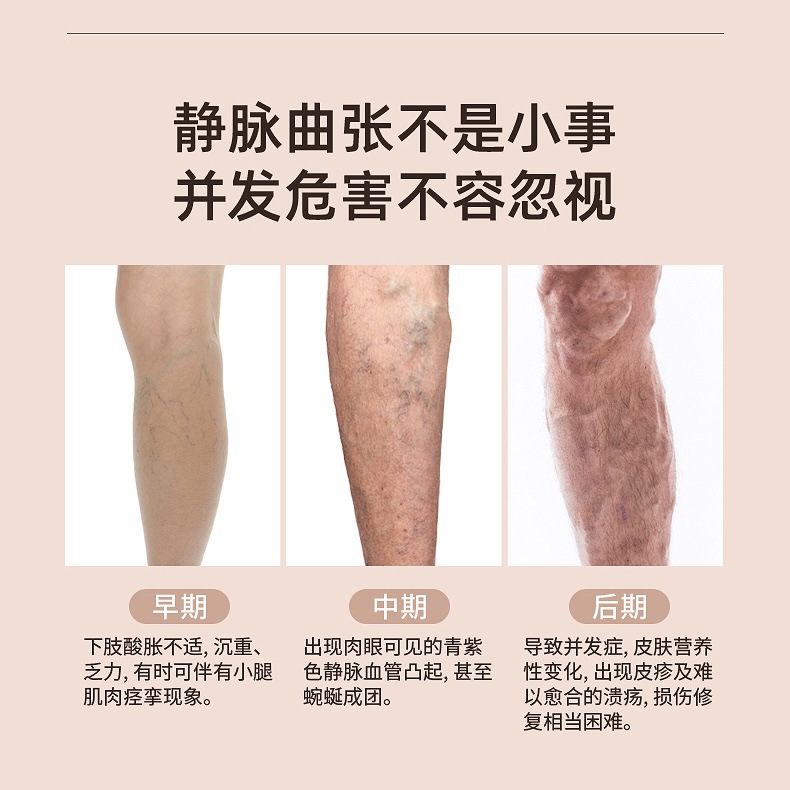 Zhuochen Medical Compression Stockings for Varicose Veins, Maternity Medical Pressure Pantyhose, Anti-Varicose Long Stockings for Autumn and Winter, Thrombosis Prevention