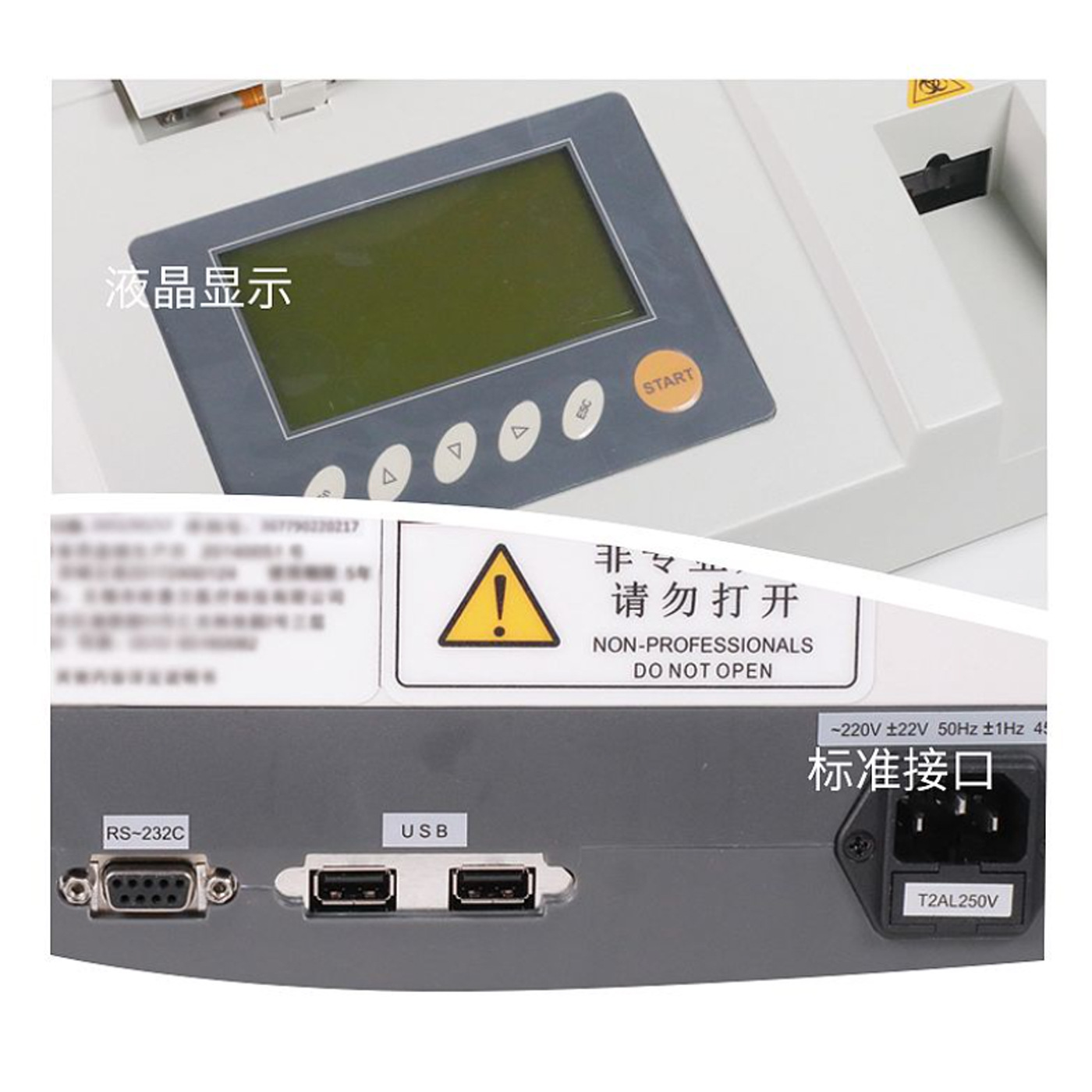 Mindray 14-Item Urine Testing Machine Hospital Outpatient Physical Examination Center Urine Analyzer Opm-151