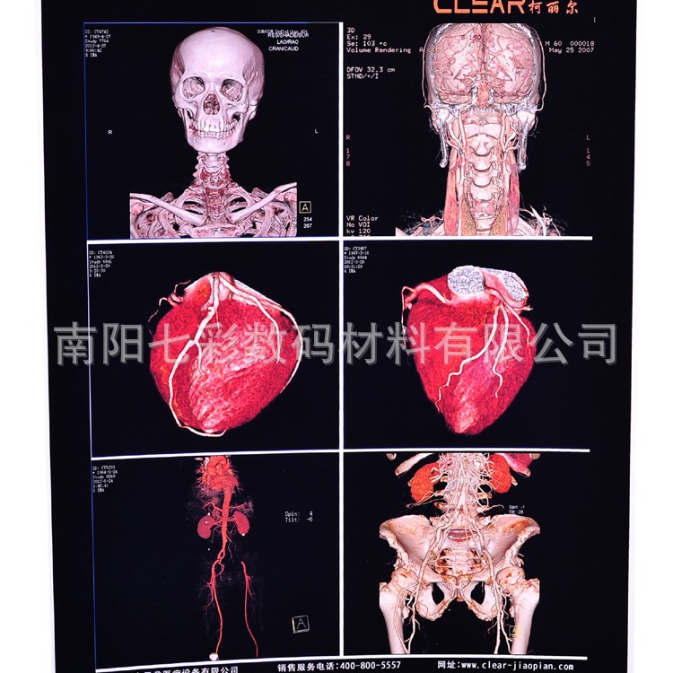 A4 medical porcelain white B ultrasound electronic gastrointestinal mirror white ink jet 150MB printing film
