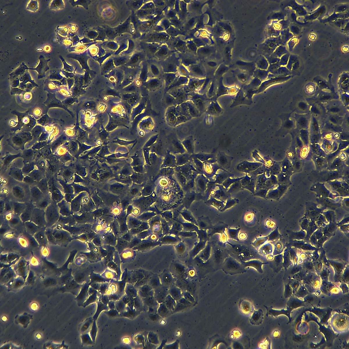 Meisenctcc Human Ovarian/Cancer Cisplatin-Resistant Strain Caov-3/Ddp