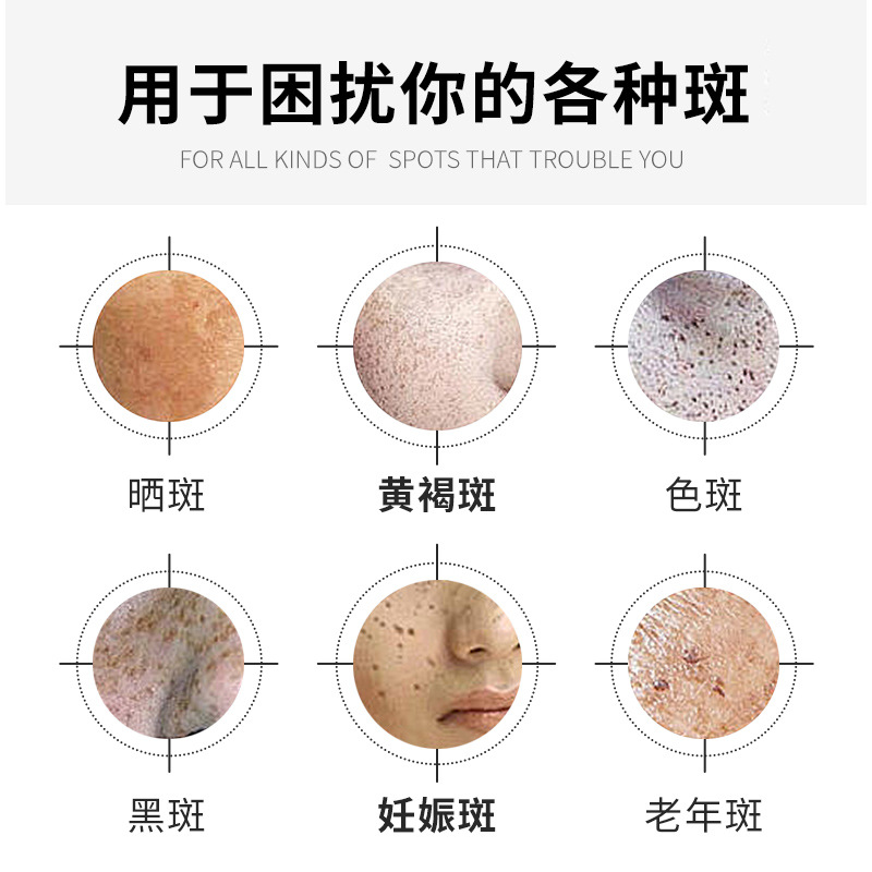 Spot Freckle Cream Wholesale, Moisturizing, Hydrating, Brightening Skin Tone, Whitening Cream Manufacturer