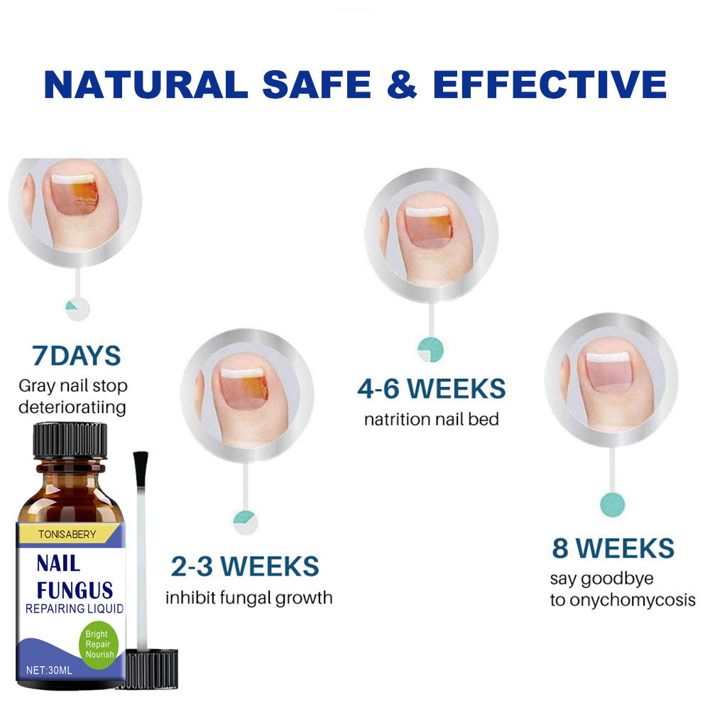 Cross-Border 30ml Nail Care Spray Repair Soft Nail Thickening Nail Onychomycosis Antibacterial Liquid Spray