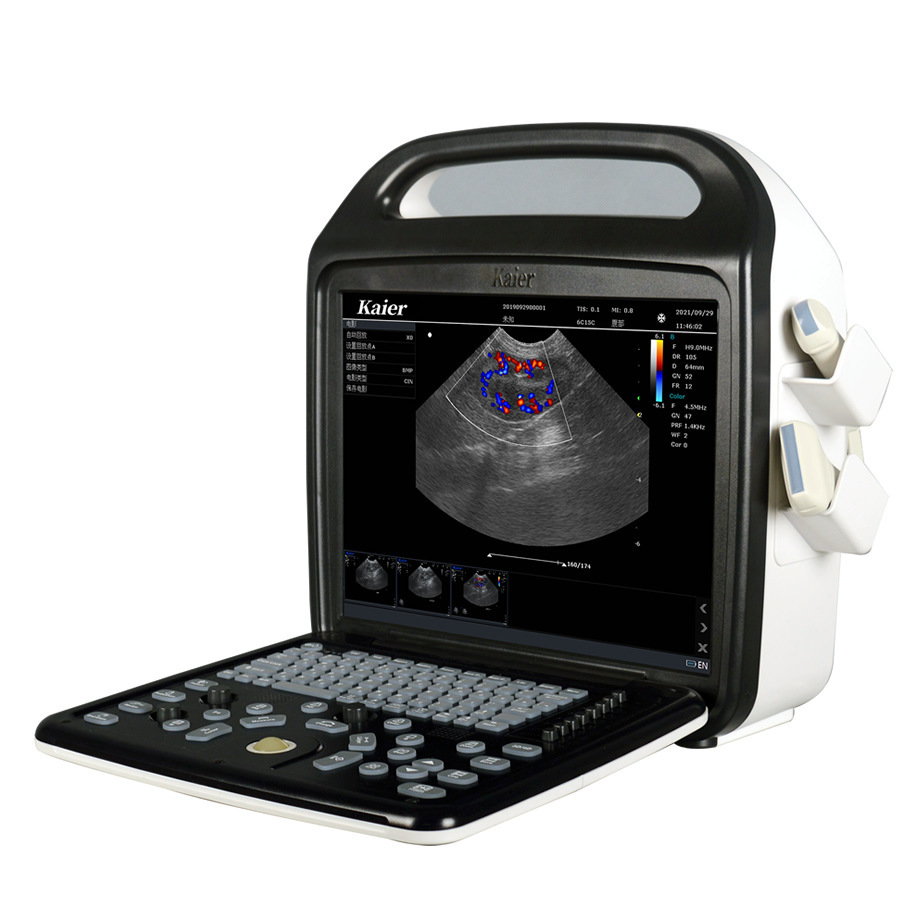 Medical Equipment Color Ultrasound B-Ultrasound Machine Manufacturer @ Xuzhou Xinma B-Ultrasound Machine Xuzhou Manufacturer Authorization Fee