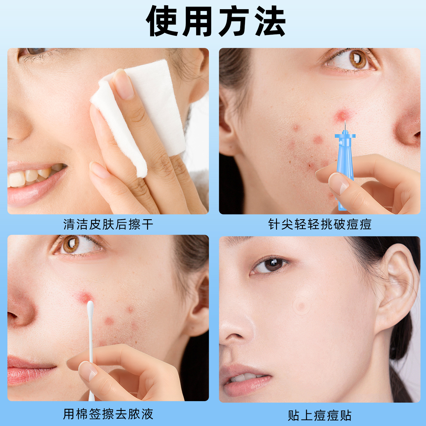 Acne Needle, Closed-Mouth Needle, Disposable Fat Particle Removal Artifact, Squeezing Acne, Clearing Acne, Acne Needle, Acne Needle Clearing Tool