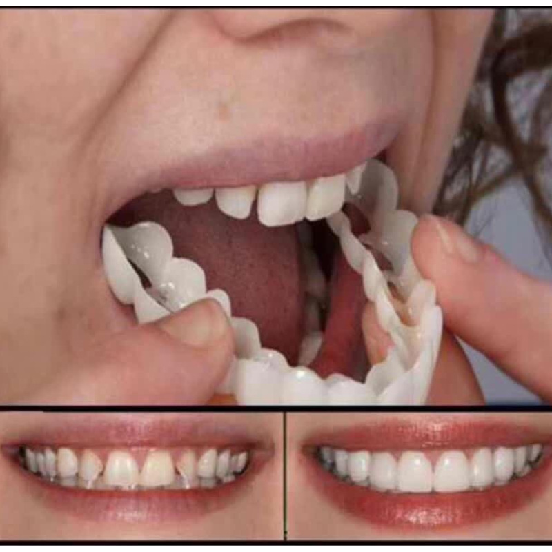 New Upper Teeth and Lower Teeth Simulated Braces Teeth Whitening Silicone Denture Braces Denture Smile Denture Braces Whitening