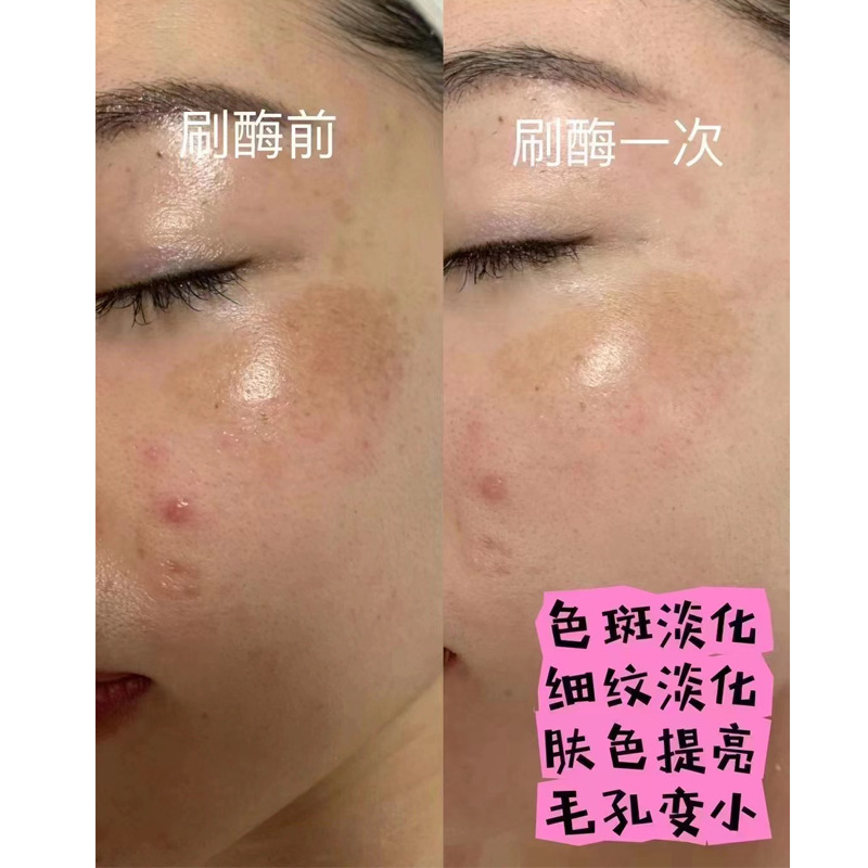 Beauty Salon Special for Brush Enzyme Activity PM Protease Beauty Brush Enzyme Lift Firming Rejuvenating Biological Enzyme Therapy Kit