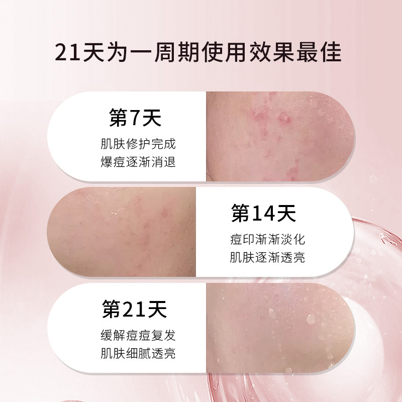 New Beauty Salon Polypeptide Oligopeptide 80,000 Active Freeze-Dried Powder Kit, 5 Sets to Improve Skin, Fade Acne Marks, and Tighten Skin