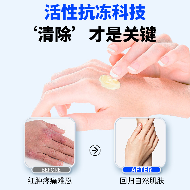 Nanjing Tongrentang Medical Frostbite Cream Anti-Freeze and Anti-Cracking Frostbite Hand Cream Frost-Cracked Hands and Feet Anti-Itch Frostbite Cream