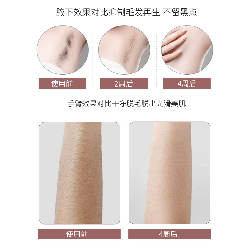 Cross-Border Men's and Women's Private Parts Gentle Hair Removal Without Hurting the Skin, Quick Hair Removal Device, Strong Pulse Hair Removal Device, Freezing Point Hair Removal Device