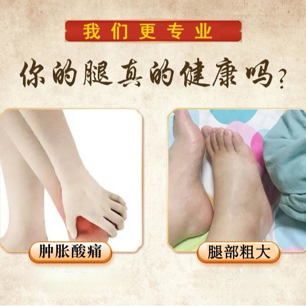 Lutong No. 3 Lower Limb Thrombosis