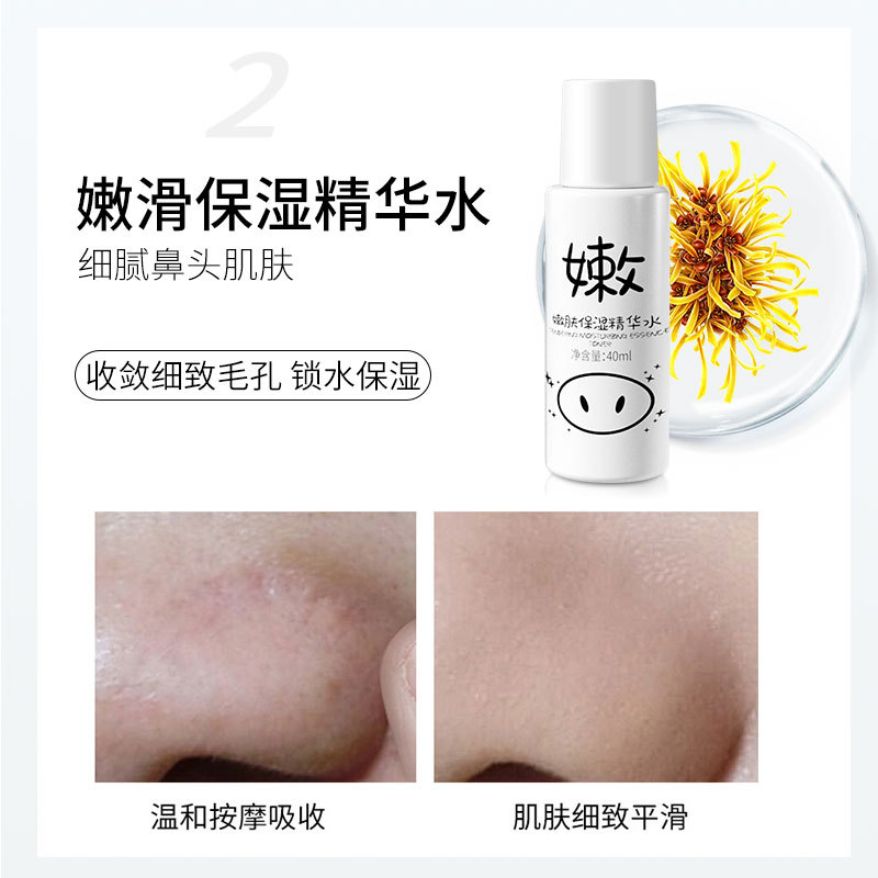Korean Piggy Yogurt Blackhead Exporting Liquid Hydrating Moisturizing Essence Water Skin Care Products Manufacturer Wholesale Dropshipping