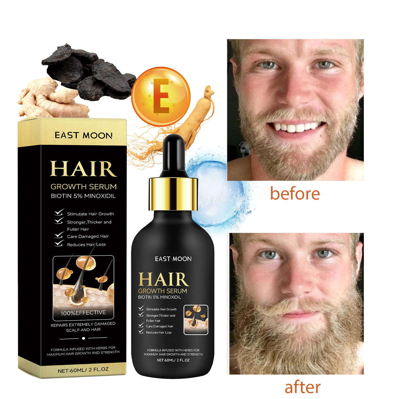 East Moon Beard Hair Growth Liquid Men's Beard Hair Nourishing Thick Anti-drop Care Growth Liquid