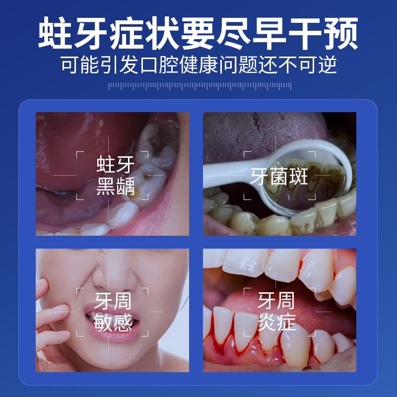Beijing Tongrentang Inner Court Uses Medical Periodontitis, Gum Recession, Tooth Decay Repair, Regeneration, Anti-Inflammation and Prevention of Dental Caries
