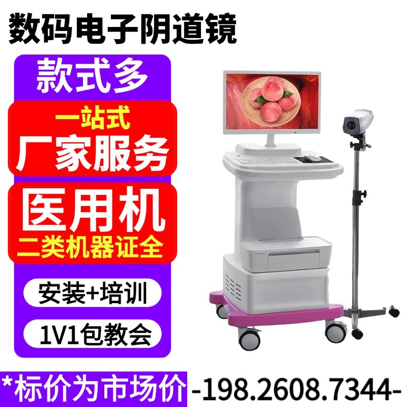 Electronic Vaginal Digital System Mirror 6000 Hd System Endoscope Gynecological Colposcopy System Maintenance Fee